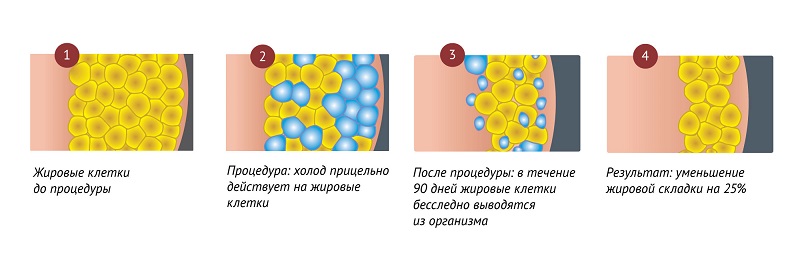 действие криолиполиза